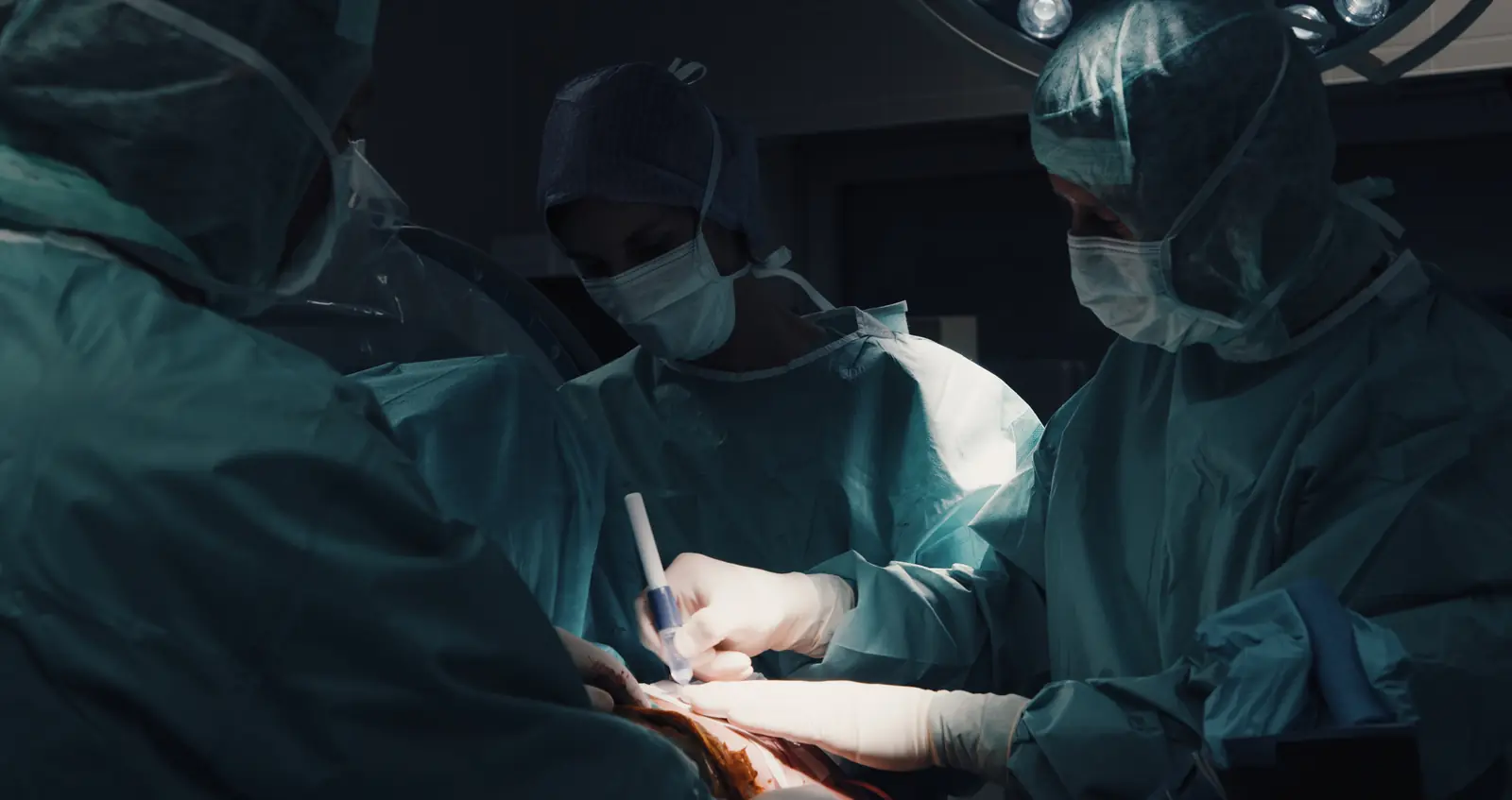 Operationsteam bei einem arthroskopischen Eingriff